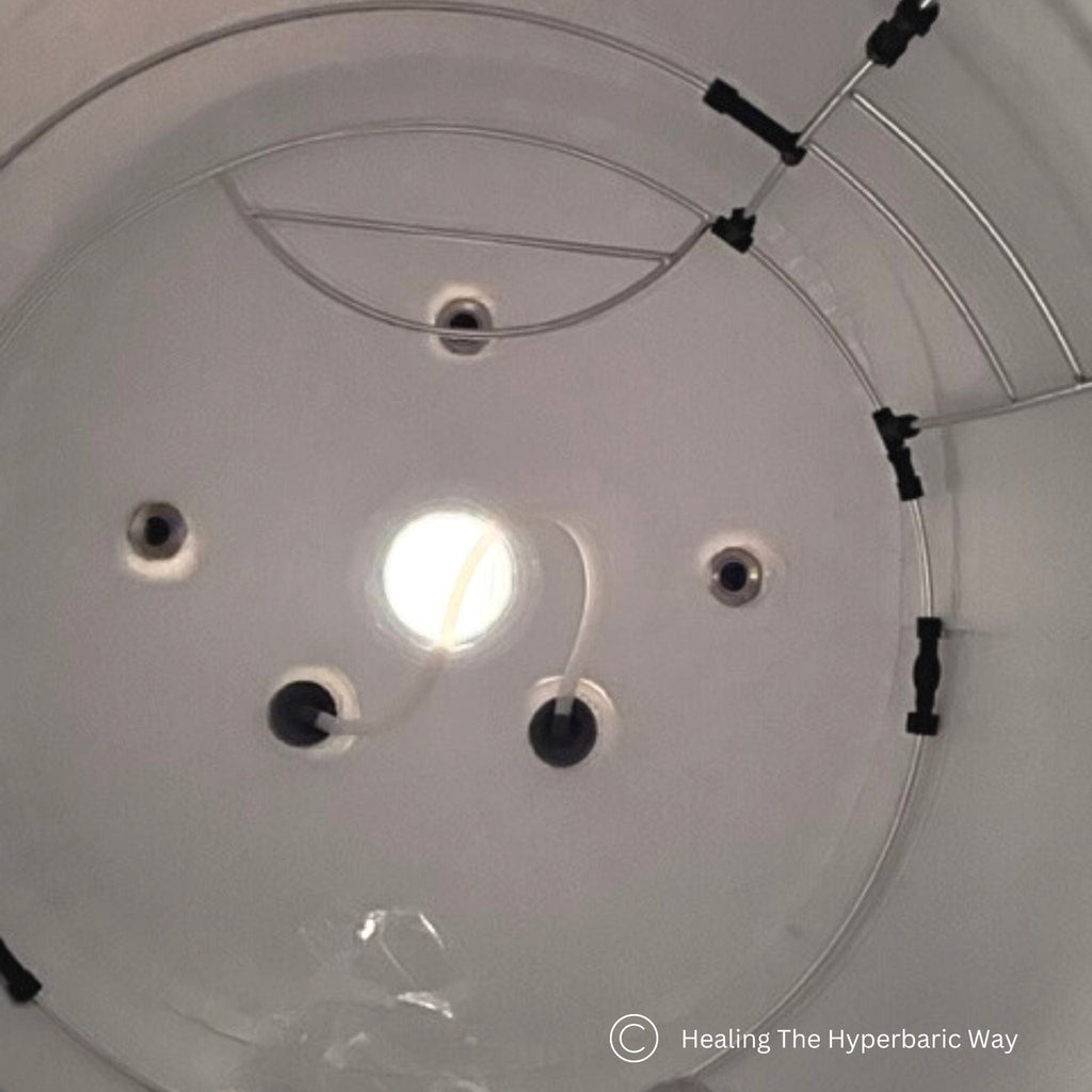 how does hyperbaric oxygen work